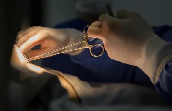 Cirurgia com fios Maxcol